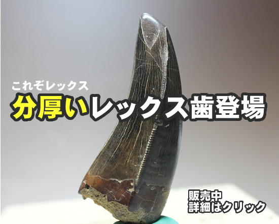 これぞレックス分厚いレックス歯登場